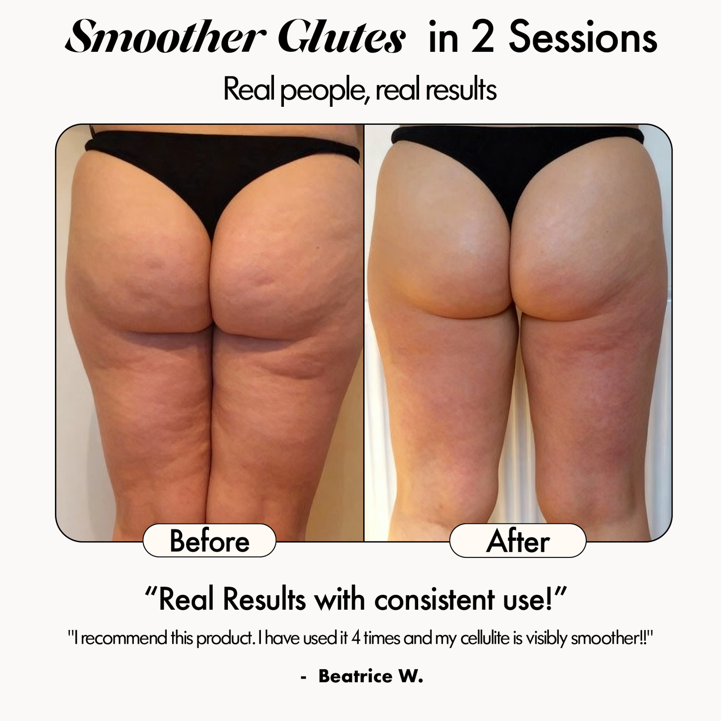 Evero® Sculptor Full Body Contour Device with Heat & EMS