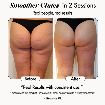 Evero® Sculptor Full Body Contour Device with Heat & EMS