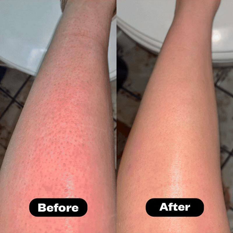 Evero® Cyperus Rotundus Oil