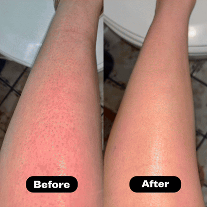 Evero® Cyperus Rotundus Oil